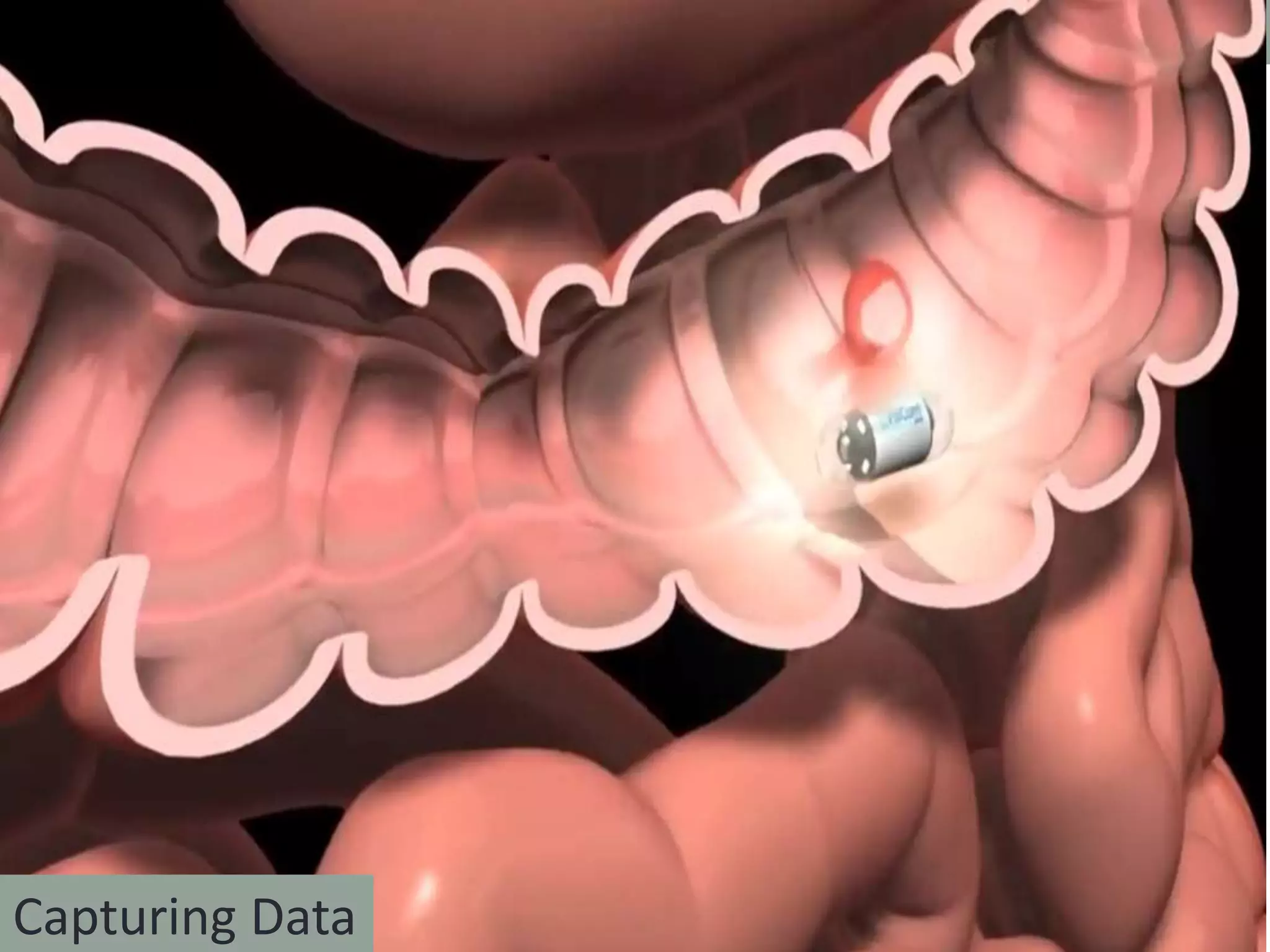 Ingestible Robots
Capturing Data
 