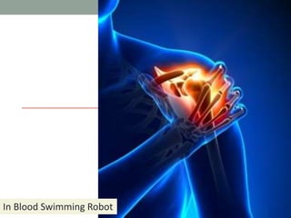 Ingestible Robots
In Blood Swimming Robot
 