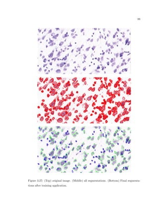 28 
Figure 2.12: For a given region of interest, the cell information can be represented by a 
density of a certain nominal cell type i in a phase space of ordinal cell properties, such as 
x,y,z location, size, shape. 
Figure 2.13: Using Stereology, a detailed measurement can be made on a smaller region of 
interest called a sampling region (roi), then that information is used to determine what the 
measurement would be on the entire region. 
methods that can obtain the resolution and breadth measurement of these densities other 
than neuroanatomy, which involves the laborious task of slicing the brain tissue, staining the 
tissue, mounting the tissue onto glass slides, and manually observing the cells underneath 
a microscope. For measurements of large areas containing millions of neurons, the direct 
calculation would quickly become impossible. The method of calculating M in a reasonable 
amount of time is called Stereology, which is the description for the equations and methods 
used to take unbiased samples of the ROI and used them to closely determine any total 
measurement of the tissue M (see Fig. 2.13). 
Using the sampling concept of Stereology, the equation to determine the measurement 
M is: 
 