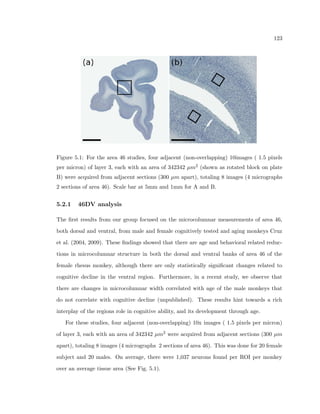 c, Rockland, MA, USA), a compound microscope system to 
focus light on the tissue and pass the image of the tissue to the CCD camera (Olympus, 
Shinjuku, Tokyo, Japan), and a Linux-based computer with serial port, usb, and  