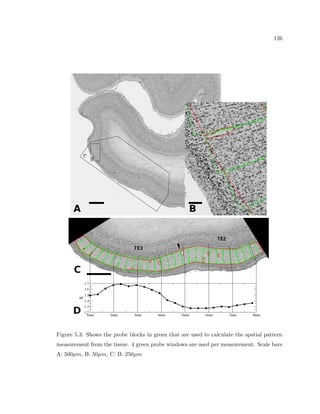42 
Figure 3.1: We use the following system at the Boston University Department of Anatomy. 
a 12-bit RGB CCD camera (Retiga, British Columbia, Canada), a motorized stage platform 
(Prior Scienti 