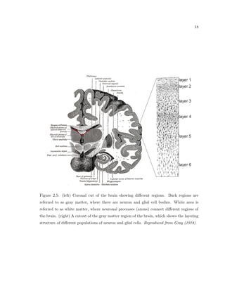 5 
Figure 1.3: Gaussian distribution of vertically oriented neuronal cell cluster in FCD and 
controls. Mean neuronal numbers are higher in FCD specimens compared to controls. The 
variance of neuron numbers is also signicantly broader in specimens with FCD compared 
to controls. Reproduced from Hildebrandt et al. (2005). 
III). The numbers counted are then histogramed (Fig. 1.3). A dierence between the two 
populations can clearly be seen, and a statistically signi 