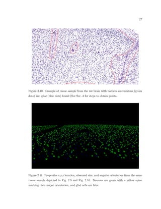 7 
this ability can be adapted by sampling more tissue. Lastly, Stereology is able to make 
measurements through the entire brain. It is these three properties that make Stereology a 
powerful method. It is our goal to incorporated these properties into a measurement tool 
for second order, spatial arrangement properties of the brain. 
We attempt to satisfy such measurement attributes by automatically collecting individ-ual 
neuron and other cell body properties (such as glial cells) of location, size, and shape, 
from every neuron within an extent of the ROI. The automatic nature of the measurement 
allows it to be performed in large datasets and reduces biases that are attributable to the 
experimental drift mentioned earlier. It also allows for measurements based on the highest 
level of statistics possible, in order to have the maximal discernibility of a feature above 
biological noise. The basic pillars of Stereology thereby attempted to be attained, we also 
mention an additional and exciting quality of such a method: it moves the neuroanatomical 
exploration of the brain away from a hypothesis driven model to a more of a data driven 
model: due to the time consuming nature of stereology, studies that investigate detailed 
anatomy are resource intensive, therefore only the investigations perceived to be the most 
salient are performed. The ability to perform investigations to answer quick hypothesis 
driven questions, or to search for unknown correlations that are not thought of by the re-searcher 
are not available in the  
