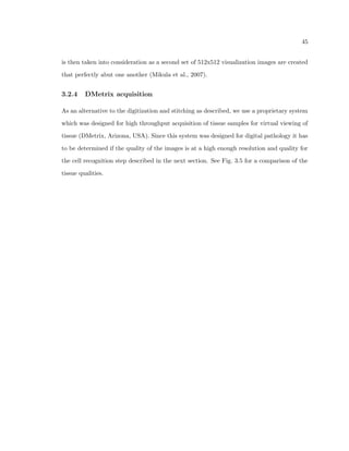 12 
monkey tissue. We then give preliminary results performed on the rat cortex, incorporating 
cell size and cell type analysis in addition to the measurement of microcolumnar properties. 
The methods developed in this dissertation, as well as the preliminary results, have been 
performed to allow a continued research eort. In Chapter 5, we describe the next steps 
and future directions of the project. 
 