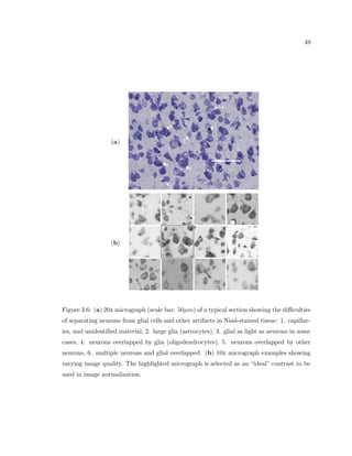 ring decision of the cell equally, rather have dierent weights based on the 
intensity of the input signal, the temporal pattern of the signal (the neurons can  