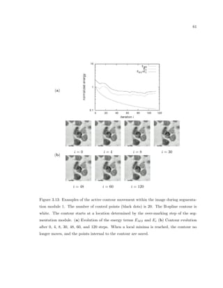 17 
Figure 2.4: Shows three main areas of the brain: the cortex (top), the cerebellum (lower 
left), and brain stem (bottom). The cortex is split into its main functional areas: the frontal 
lobe, the parietal lobe, the occipital lobe, and the temporal lobe. Reproduced from Gray 
(1918) 
2.1.2 Basic anatomy 
The brain is a biological system that does not adhere to a given rectilinear coordinate 
system. Rather, it is comprised of a set of several major complicatedly curved regions 
that have developed for tasks such as those necessary for bodily function (brain stem), 
muscle coordination (cerebellum) and higher level processing of sensory input (cortex) (see 
Fig. 2.4). 
We focus on the cortex, which can be split up further into areas that focus on certain 
aspects of higher level processing of sensory input, such as integration of sensory information 
(parietal lobe), visual processing (occipital lobe), auditory processing (temporal lobe), and 
executive function (frontal lobe). The cortex is comprised of the gray matter, the layer of 
neuron and glial cells on the folded surface of the cortex, and white matter, the area which 
is mainly processes (axons) traveling between dierent brain regions (see Fig. 2.5). 
 