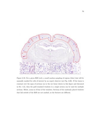 cant loss of cortical neurons in gray matter (Peters et al., 1998). Instead, it seems 
 