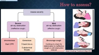 The Chocking Process Choking | PPTX