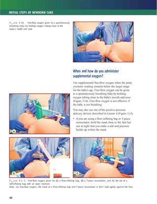 Comprehensive Neonatal Resuscitation Program: Foundations and Practices ...
