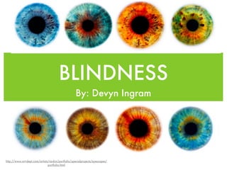 BLINDNESS
                                                   By: Devyn Ingram




http://www.art-dept.com/artists/rankin/portfolio/specialprojects/eyescapes/
                               portfolio.html
 