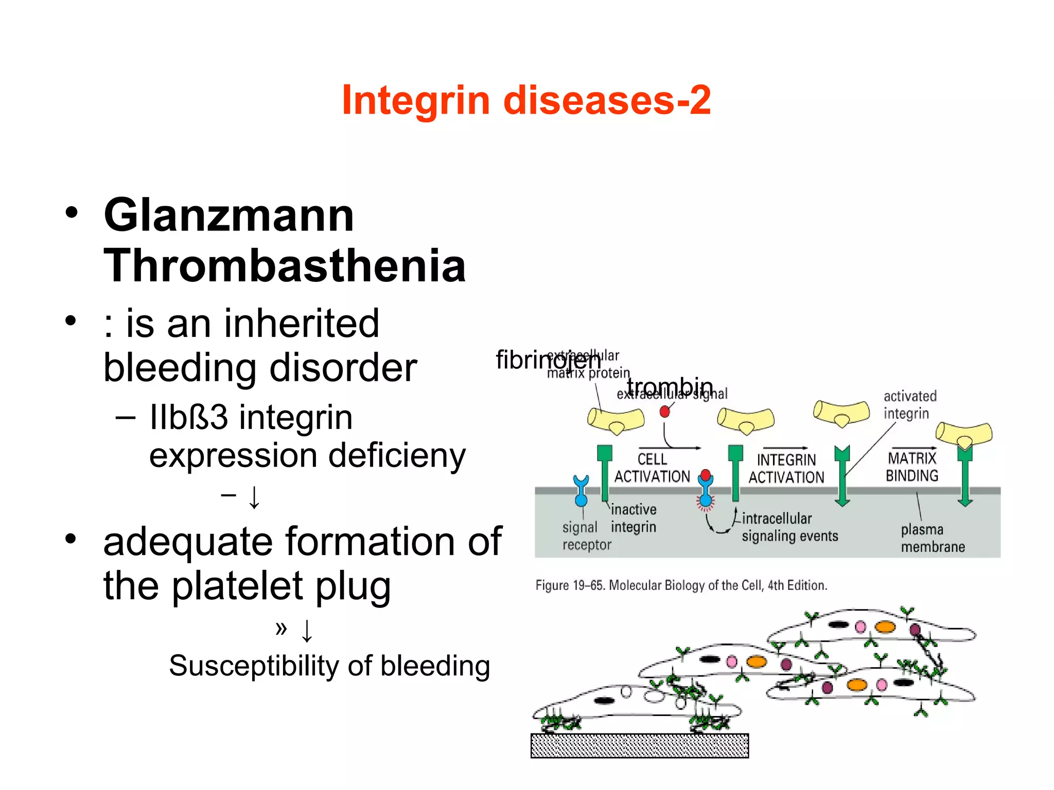 Integrin diseases-2

• Glanzmann
Thrombasthenia
• : is an inherited
bleeding disorder

fibrinojen

– IIbß3 integrin
expression deficieny
– ↓

• adequate formation of
the platelet plug
» ↓

Susceptibility of bleeding

trombin

 