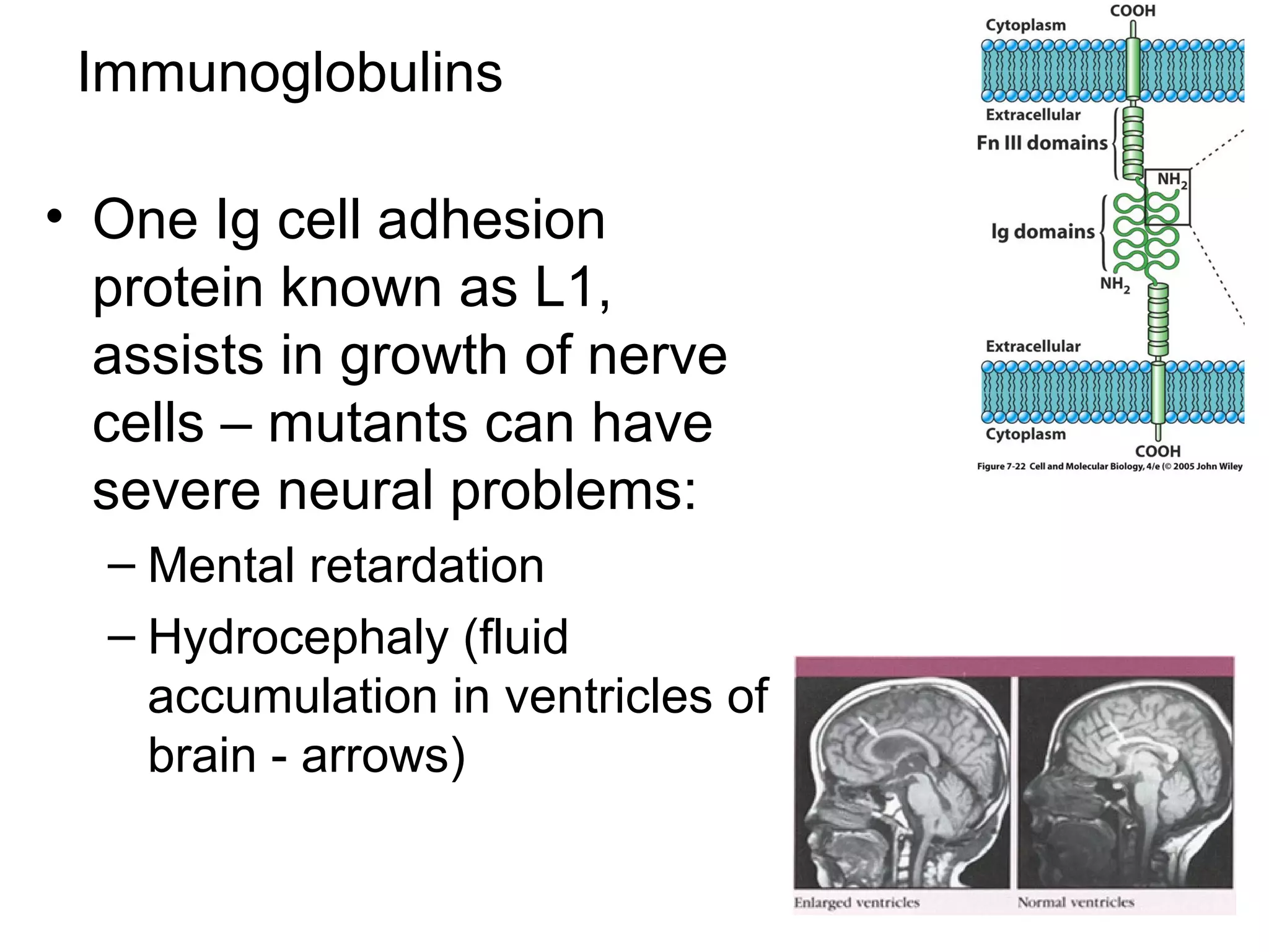 Immunoglobulins
• One Ig cell adhesion
protein known as L1,
assists in growth of nerve
cells – mutants can have
severe neural problems:
– Mental retardation
– Hydrocephaly (fluid
accumulation in ventricles of
brain - arrows)

 
