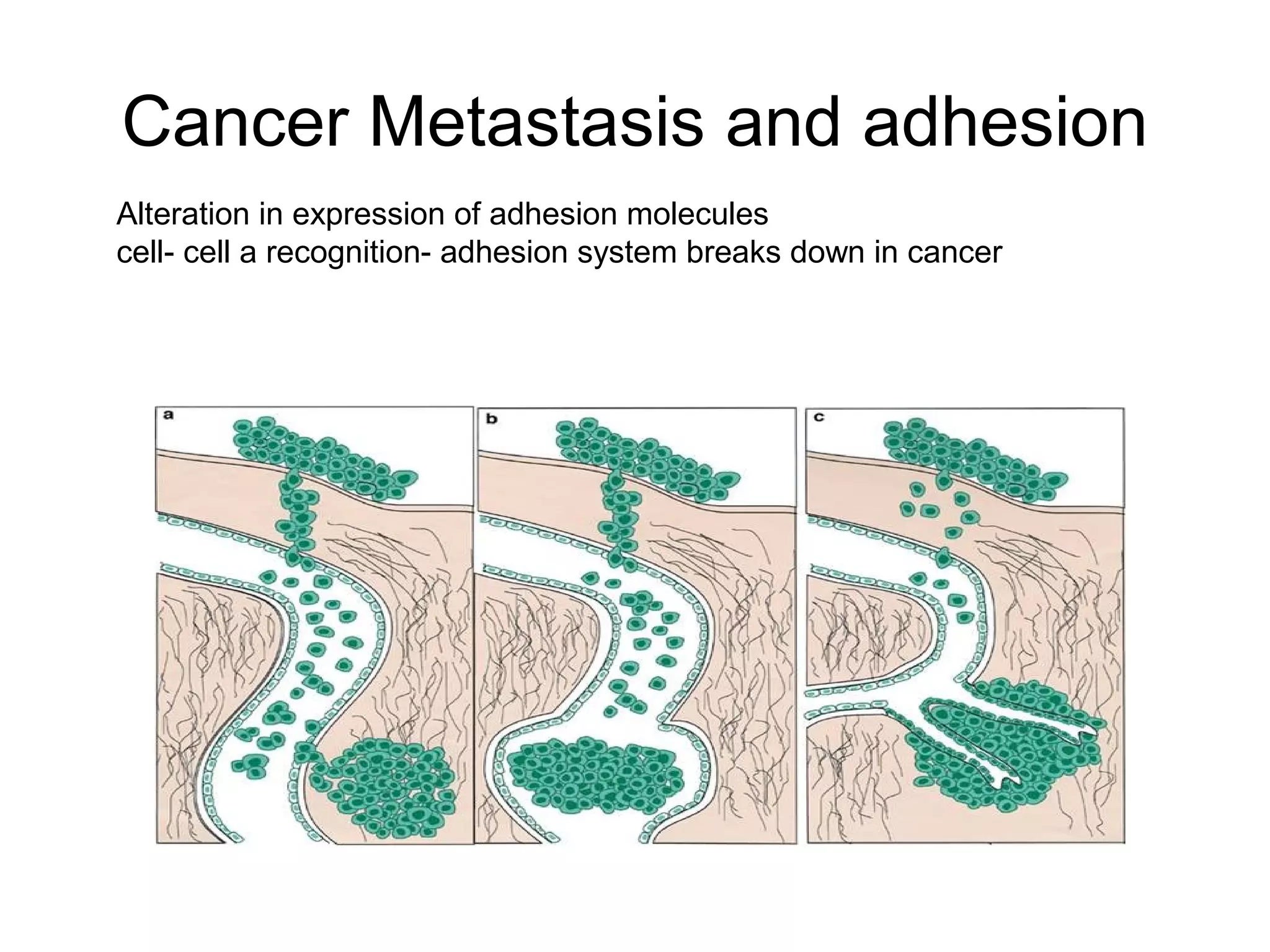Cancer Metastasis and adhesion
Alteration in expression of adhesion molecules
cell- cell a recognition- adhesion system breaks down in cancer

 