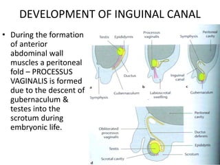 DEVELOPMENT OF INGUINAL CANAL
• During the formation
of anterior
abdominal wall
muscles a peritoneal
fold – PROCESSUS
VAGI...