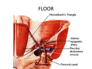 FLOOR
Lacunar
ligament
Inguinal
ligament
 