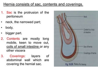 Hernia consists of sac, contents and coverings.
1. Sac is the protrusion of the
peritoneum
• neck, the narrowed part;
• body,
• bigger part.
2. Contents are mostly long
mobile, keen to move out,
coils of small intestine or any
other viscera
3. Coverings: layers of
abdominal wall which are
covering the hernial sac.
 