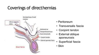 Coverings of directhernias
• Peritoneum
• Transversalis fascia
• Conjoint tendon
• External oblique
aponeurosis
• Superficial fascia
• Skin
 