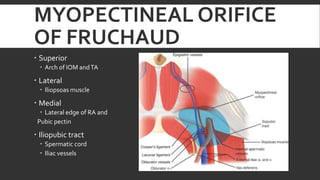MYOPECTINEAL ORIFICE
OF FRUCHAUD
 Superior
 Arch of IOM and TA

 Lateral
 Iliopsoas muscle

 Medial
 Lateral edge of RA and
Pubic pectin

 Iliopubic tract
 Spermatic cord
 Iliac vessels

 