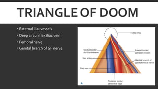TRIANGLE OF DOOM
 External iliac vessels
 Deep circumflex iliac vein
 Femoral nerve
 Genital branch of GF nerve

 