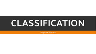 CLASSIFICATION
Inguinal Hernia

 