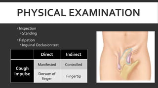 PHYSICAL EXAMINATION
 Inspection
 Standing
 Palpation
 Inguinal Occlusion test

Direct
Cough
Impulse

Indirect

Manifested

Controlled

Dorsum of
finger

Fingertip

 