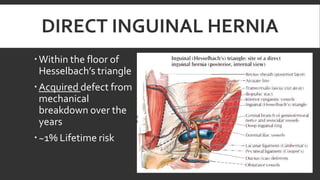 DIRECT INGUINAL HERNIA
 Within the floor of
Hesselbach’s triangle
 Acquired defect from
mechanical
breakdown over the
years
 ~1% Lifetime risk

 