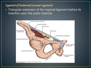 Ligament of Gimbernat (Lacunar Ligament): 
• Triangular extension of the inguinal ligament before its 
insertion upon the pubic tubercle. 
 