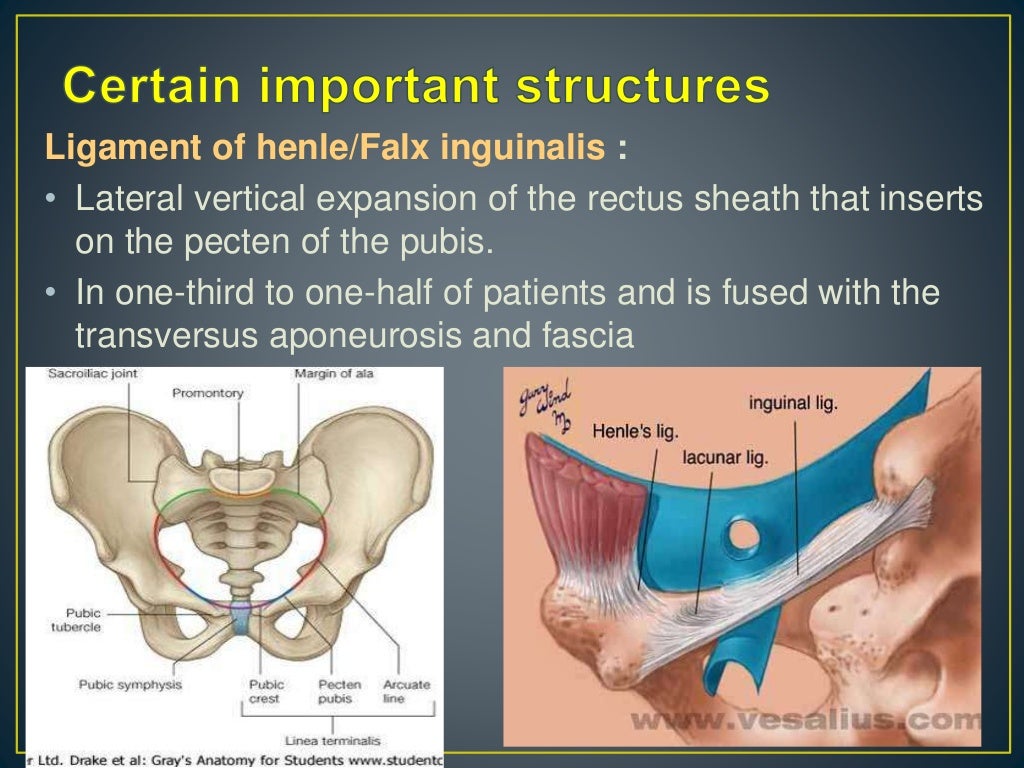 Inguinal hernia ppt