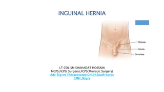 INGUINAL HERNIA
LT COL SM SHAHADAT HOSSAIN
MCPS,FCPS( Surgery),FCPS(Thoracic Surgery)
Adv Trg on Thoracoscopy,CNUH,South Korea
CMH ,Bogra
 
