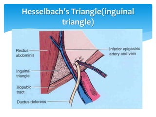 Hesselbach’s Triangle(inguinal
triangle)
 