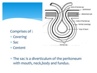 Comprises of :
 Covering
 Sac
 Content
 The sac is a diverticulum of the peritoneum
with mouth, neck,body and fundus.
 