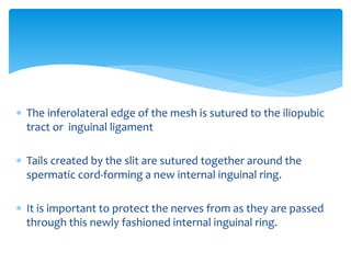  The inferolateral edge of the mesh is sutured to the iliopubic
tract or inguinal ligament
 Tails created by the slit are sutured together around the
spermatic cord-forming a new internal inguinal ring.
 It is important to protect the nerves from as they are passed
through this newly fashioned internal inguinal ring.
 