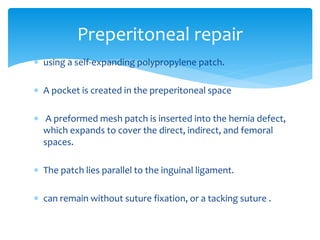  using a self-expanding polypropylene patch.
 A pocket is created in the preperitoneal space
 A preformed mesh patch is inserted into the hernia defect,
which expands to cover the direct, indirect, and femoral
spaces.
 The patch lies parallel to the inguinal ligament.
 can remain without suture fixation, or a tacking suture .
Preperitoneal repair
 