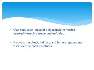  After reduction- piece of polypropylene mesh is
inserted through a trocar and unfolded.
 It covers the direct, indirect, and femoral spaces and
rests over the cord structures
 