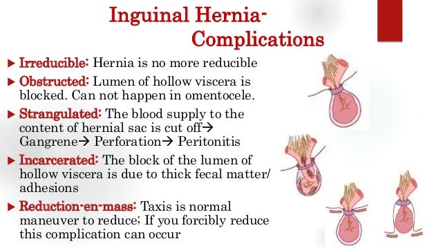 Causes Of Postoperative Pain Following Inguinal Hernia Repair