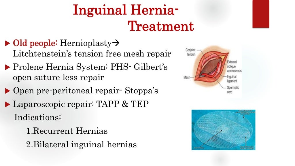 Inguinal Hernia Groin Swellings