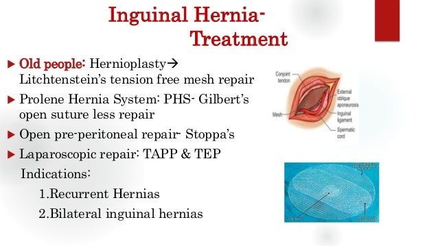Inguinal Hernia Types Of Hernia Treatment Hernia Surgery In