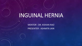 INGUINAL HERNIA
MENTOR : DR. KISHAN RAO
PRESENTER : ASHMITA JAIN
 