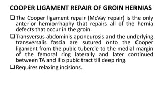 Mcvay Incision Inguinal hernia and its management | PPTX