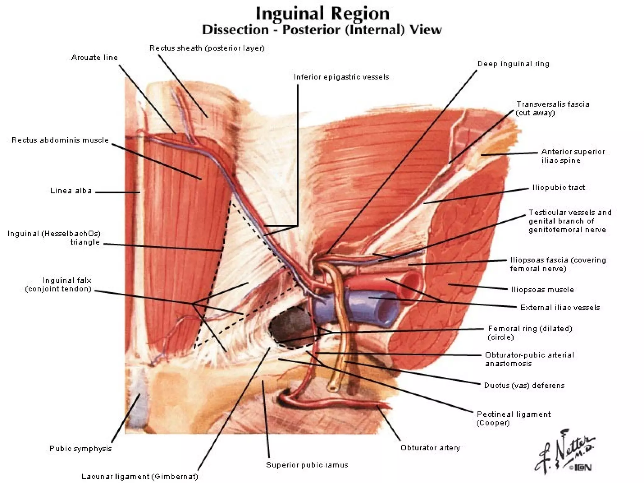 Inguinal hernia examination | PPT