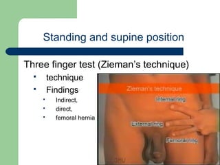 Inguinal hernia examination
