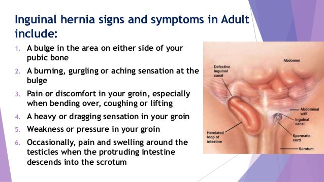 Hernia Symptoms California Hernia Specialists
