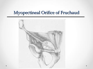 Myopectineal Orifice of Fruchaud

 