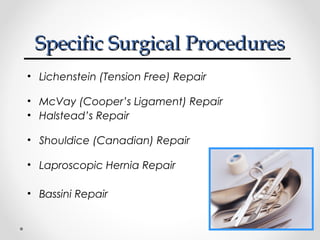 Specific Surgical Procedures
• Lichenstein (Tension Free) Repair
• McVay (Cooper’s Ligament) Repair
• Halstead’s Repair
• Shouldice (Canadian) Repair
• Laproscopic Hernia Repair
• Bassini Repair

 