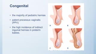 Congenital
• the majority of pediatric hernias
• patent processus vaginalis
(PPV)
• the high incidence of indirect
inguinal hernias in preterm
babies.
 