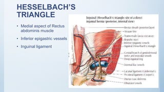 HESSELBACH’S
TRIANGLE
• Medial aspect of Rectus
abdominis muscle
• Inferior epigastric vessels
• Inguinal ligament
 