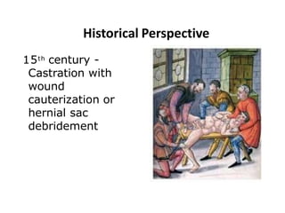 Historical Perspective
15th century -
Castration with
wound
cauterization or
hernial sac
debridement
 