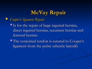 Mcvay Incision Inguinal hernia lecture............. .ppt