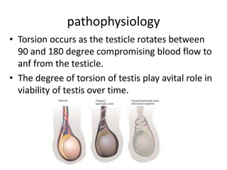 INGUINO SCROTAL SWELLINGS pptx