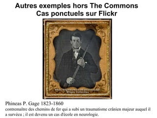 Autres exemples hors The Commons
           Cas ponctuels sur Flickr




Phineas P. Gage 1823-1860
contremaître des chemins de fer qui a subi un traumatisme crânien majeur auquel il
a survécu ; il est devenu un cas d'école en neurologie.
 